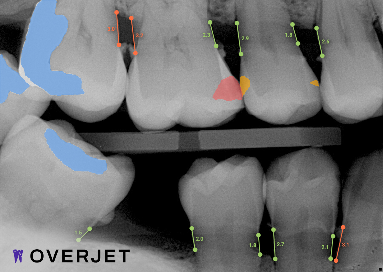 Refresh Dental